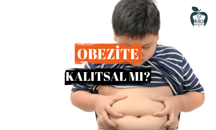 Obezite kalitsal mi