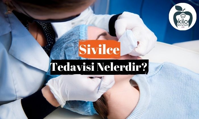 Sivilce Tedavisi Nelerdir?