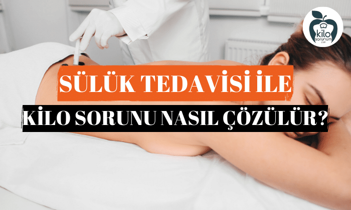 Sülük Tedavisi ile Kilo Sorunu Nasıl Çözülür?